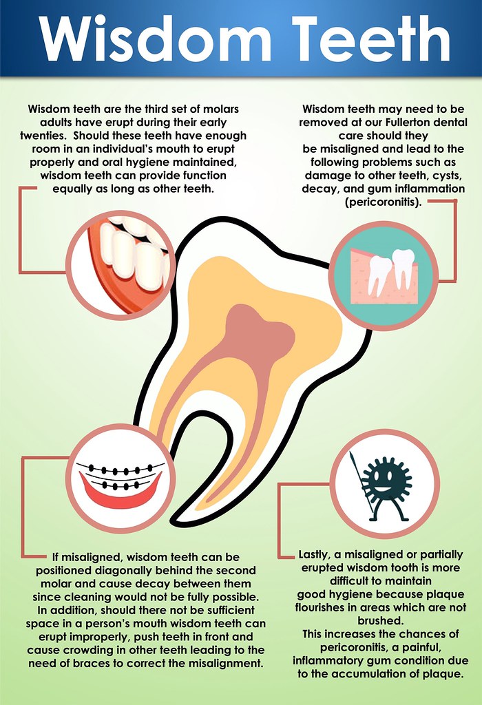 dos and don'ts after wisdom teeth removal - signs of infected wisdom teeth to watch for
